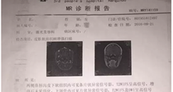 医美平台美黛拉引纠纷：用户投诉 谁来背锅